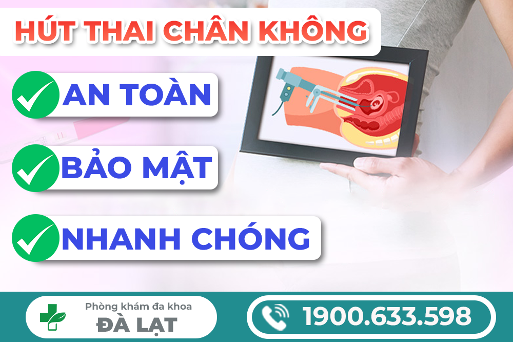 Hình ảnh minh họa